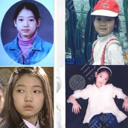 樸信惠整容前后照片