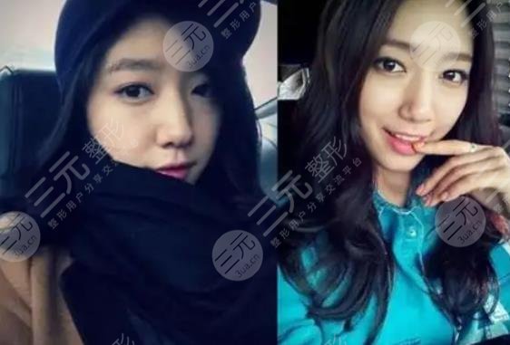 樸信惠整容前后照片