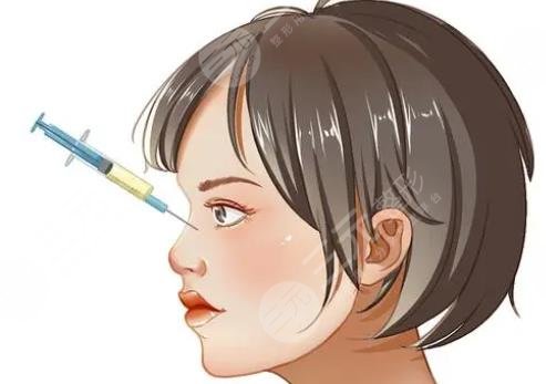 注射隆鼻