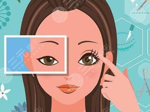 女子割雙眼皮!當(dāng)場(chǎng)喪命