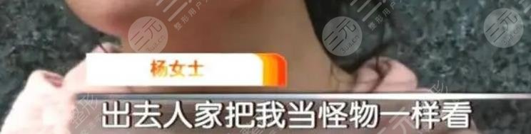 女子整容失敗崩潰大哭