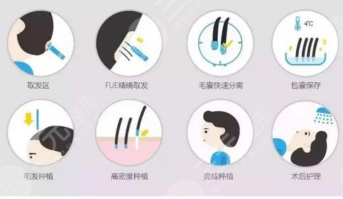 植發(fā)過程原理