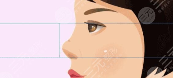 假體隆鼻一周恢復(fù)圖片對比，給想做的姐妹們一個(gè)參考對象，不要被嚇到哦~