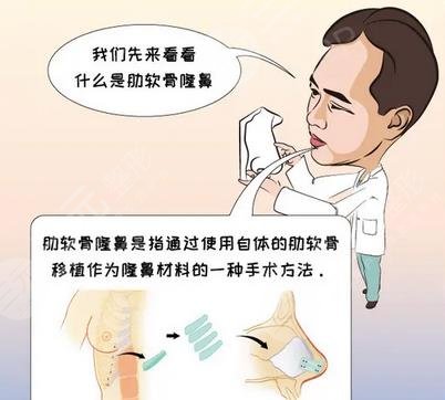 超肋骨鼻有哪些優(yōu)勢?