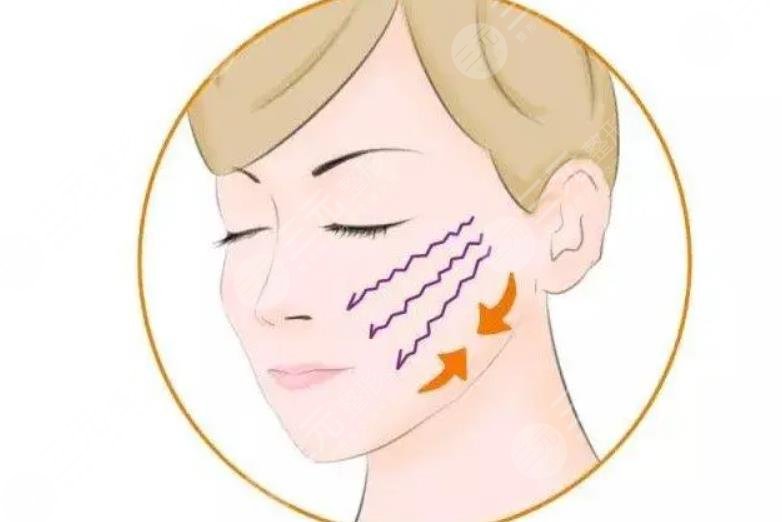 哪些因素影響臉部提拉手術費用