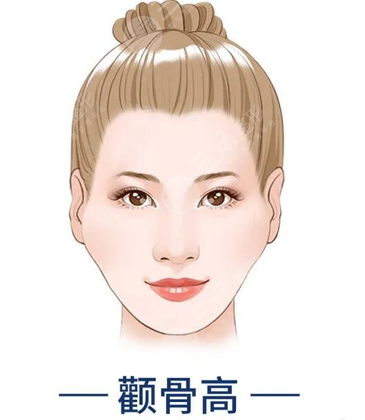 磨顴骨前后對比圖驚掉網(wǎng)友下巴！術(shù)后告別兇巴巴的氣場，秒變甜美萌妹~