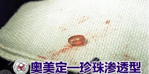 奧美定取出價(jià)格大概需要多少