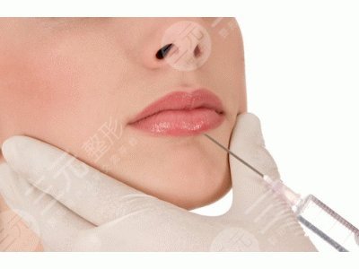 嘴唇厚怎么變??？幾點日常小妙招分享！附上唇部整形手術(shù)介紹～