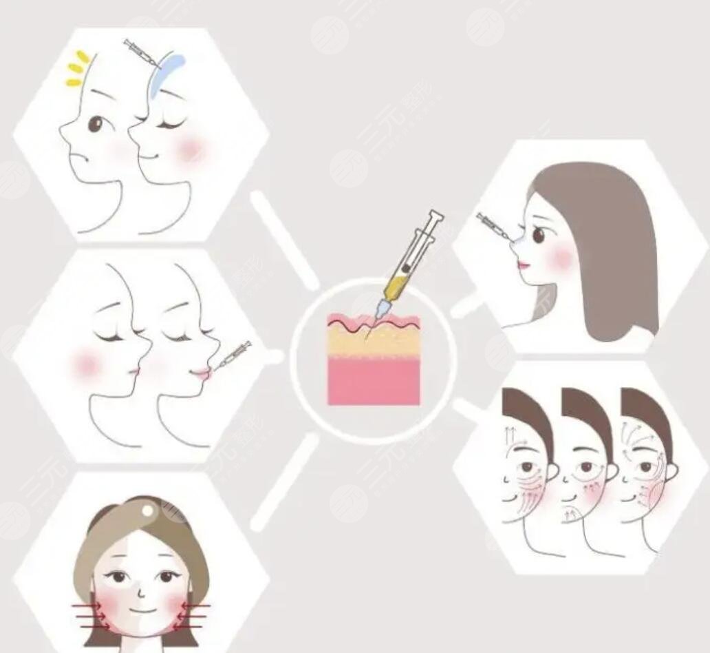 *玻尿酸注射后如何養(yǎng)護(hù)皮膚果維持時(shí)間長(zhǎng)？