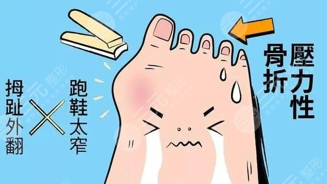 馬桂文大腳骨手術(shù)靠譜嗎