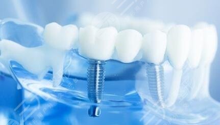 北京中諾口腔醫(yī)院科普知識(shí)