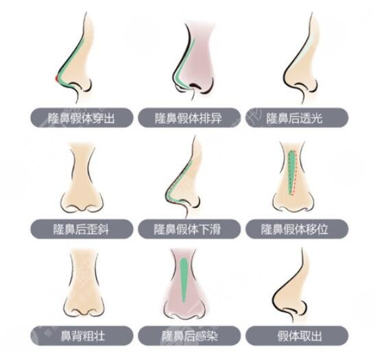 北京伊美爾何禎平醫(yī)生擅長項(xiàng)目科普