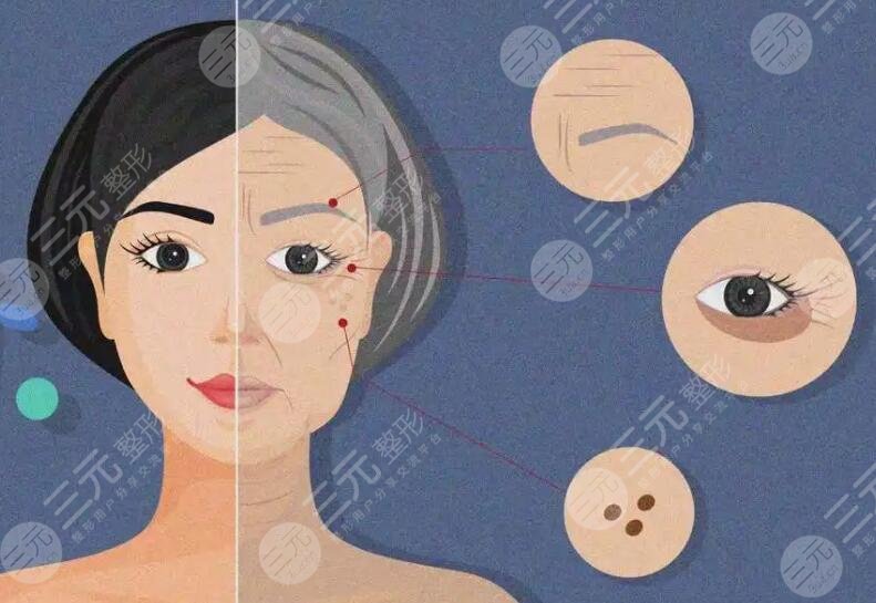 冰電波拉皮多少錢(qián)一次