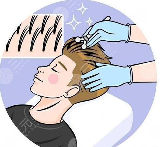 頭發(fā)種植大概需要多久能恢復(fù)?