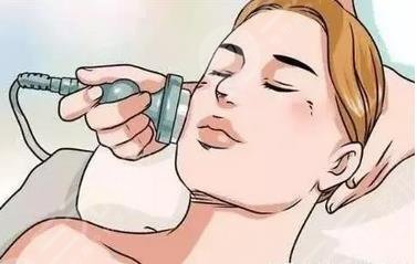 河北省二院點(diǎn)陣激光案例分享