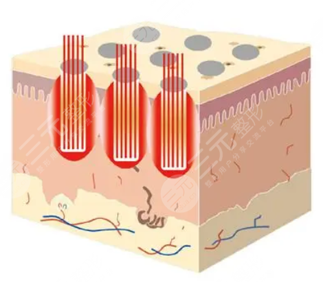 河北省二院點(diǎn)陣激光掛哪個(gè)科