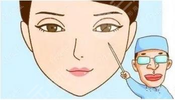 中大醫(yī)院割雙眼皮做的好嗎