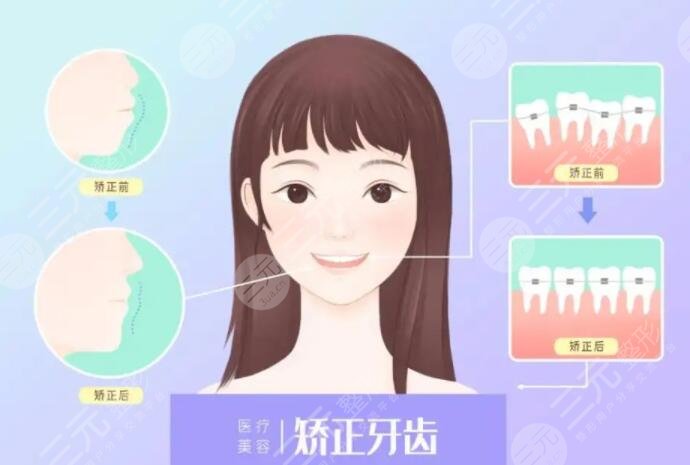 牙齒矯正年齡限制在多少歲？幾歲是正畸的黃金年齡？來看看你處在哪個年齡段！