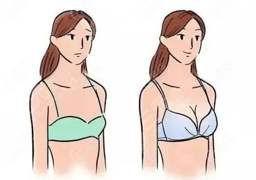 上海九院隆胸手術(shù)