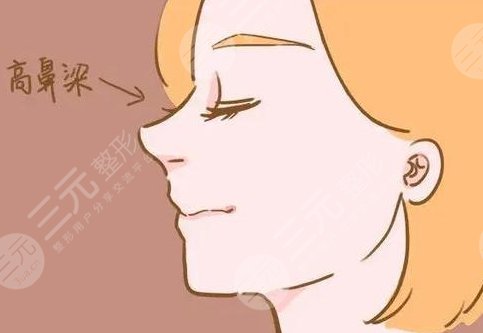 怎樣讓鼻梁變高