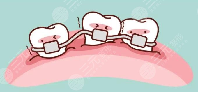 牙齒正畸手術(shù)