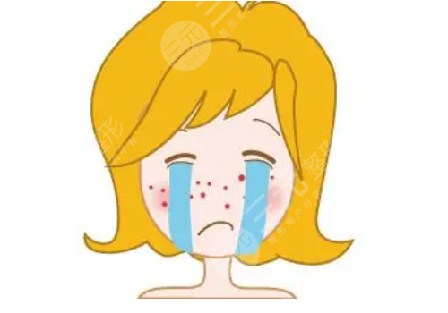 e光祛痘多少錢一次？