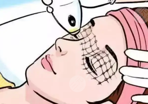 去魚尾紋方法有哪些?