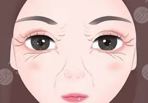 去魚尾紋方法有哪些?