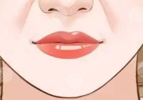 厚嘴唇怎么變薄？