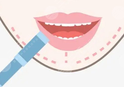 厚嘴唇怎么變薄？