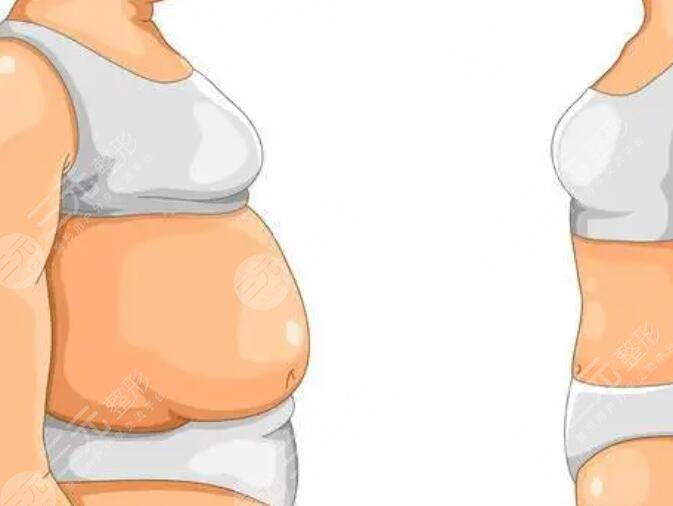 減肥的注意事項(xiàng)