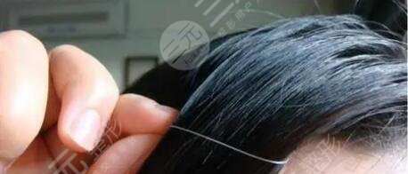 長白頭發(fā)了是什么原因?qū)е碌?