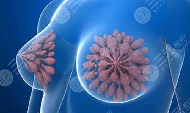 十個隆胸九個后悔是什么意思??？隆胸手術做了會后悔嗎？為什么？