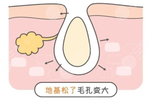 怎么收縮面部毛孔有又快速？文中3中方法你得學(xué)起來！如何預(yù)防是關(guān)鍵！