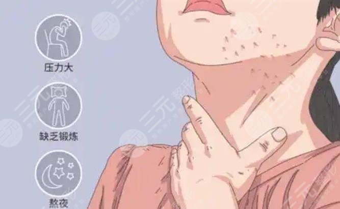 脖子上長痘