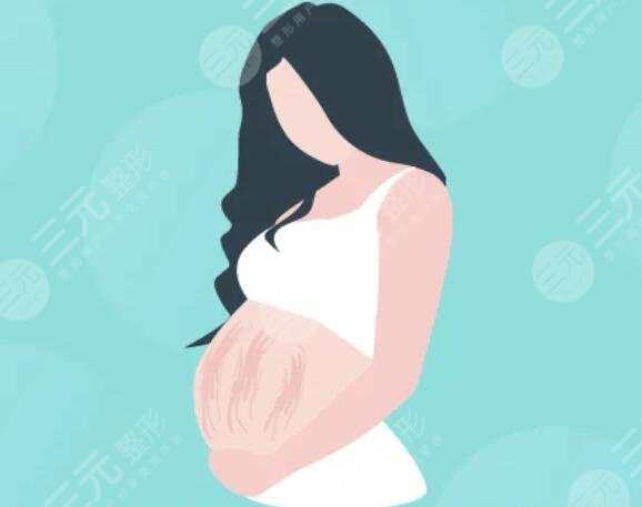 激光去除妊娠紋需要多久?