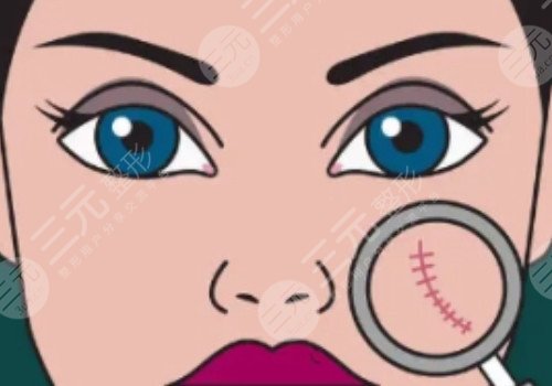 如何祛除臉上的疤痕?