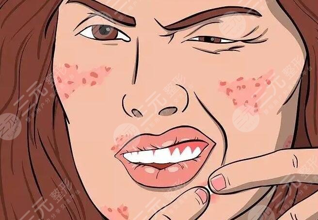 怎樣消除紅腫的痘痘更有？這幾種方法好用又操作簡單！果是肉眼可見的！