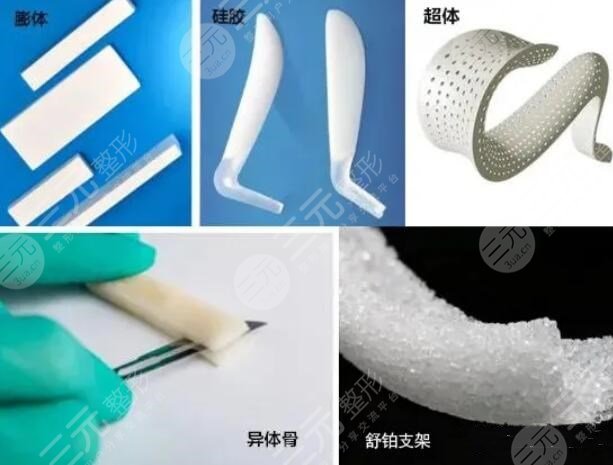 做個鼻梁需要多少錢費(fèi)用？