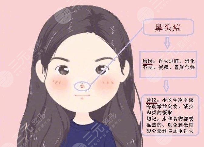 鼻子上長痘痘是什么原因引起的?