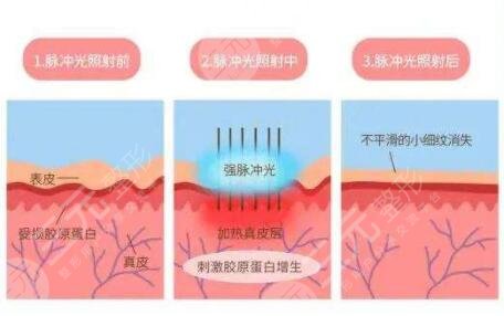皮膚美容的技術(shù)手段有哪些?