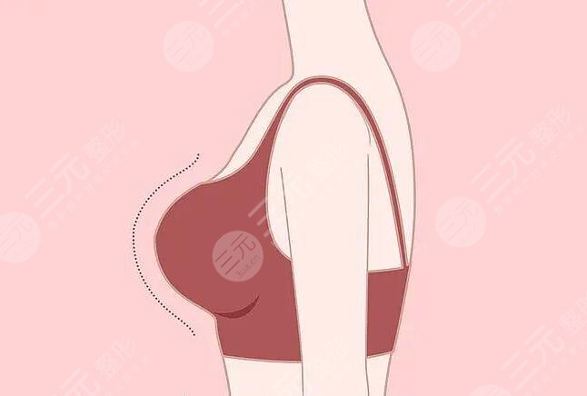 假體隆胸的材料什么牌子好？假體品牌各優(yōu)勢(shì)缺點(diǎn)詳細(xì)介紹~來(lái)選你喜歡的吧~