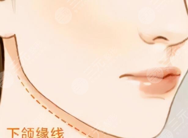 下頜角肥大矯正術(shù)術(shù)后并發(fā)癥有哪些？手術(shù)風(fēng)險(xiǎn)和注意事項(xiàng)才應(yīng)該是關(guān)注重點(diǎn)！