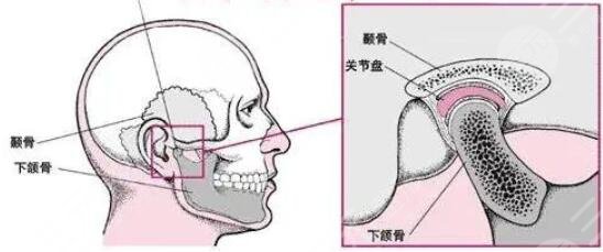 假體隆下巴的注意事項(xiàng)