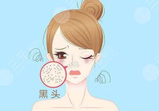 蘇打水去黑頭對(duì)皮膚有損害嗎?