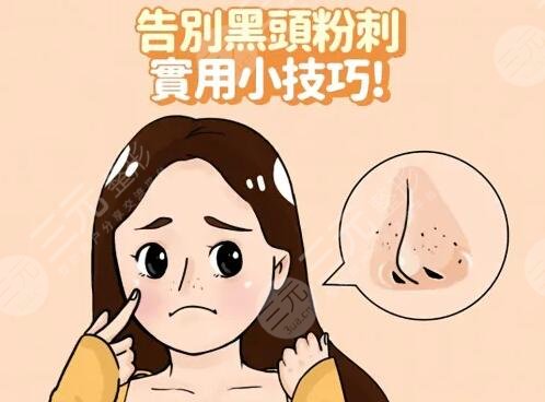 黑頭的產(chǎn)生原理