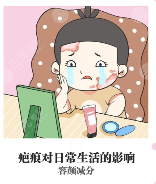 緩解疤痕好的方法有哪些?