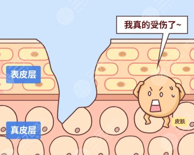 疤痕是怎樣形成的?