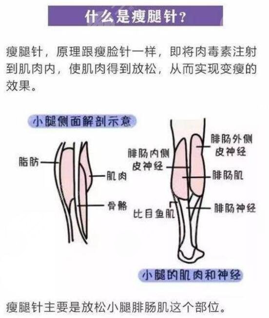 肌肉小腿怎么瘦成筷子腿肚子？