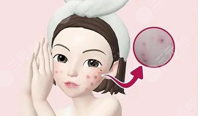 痤瘡疤痕怎么治才能徹底？這幾種有方法網(wǎng)友們親測(cè)果，給你更好選擇~